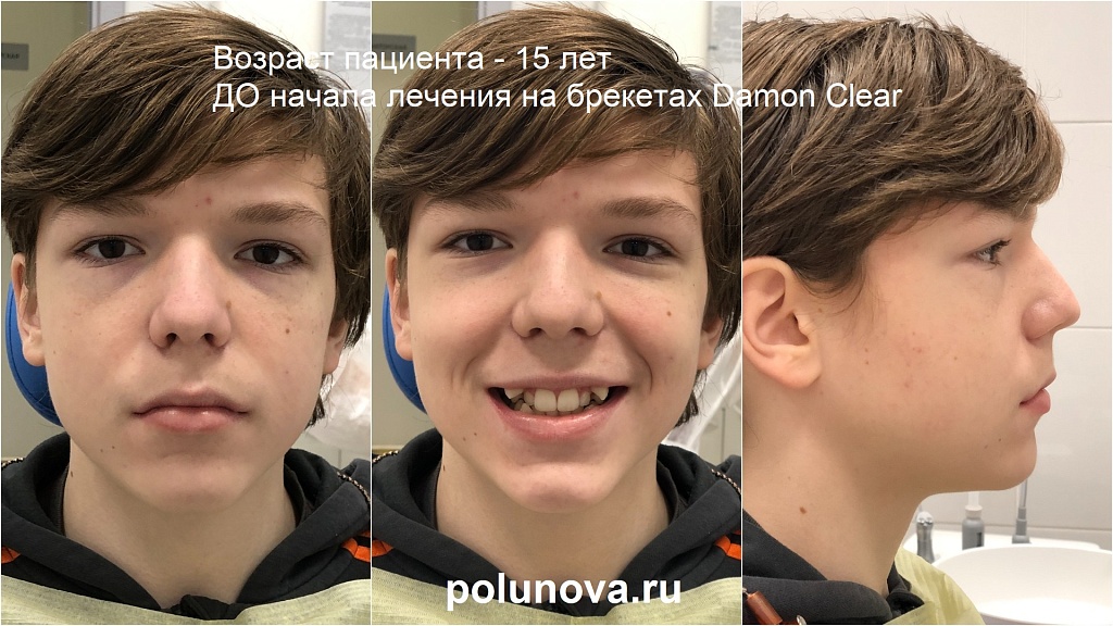 Больше помочь было некому». 15