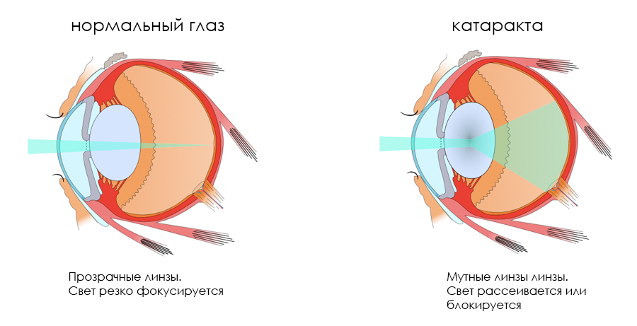 Глаз Рисунок Изображения – скачать